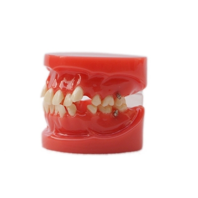 Model szkoleniowy zębów dentystycznych, model edukacyjny, funkcjonalny model ortodontyczny bez zamków